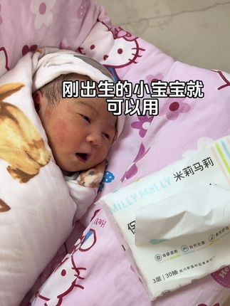 你先试用,以后宝宝的云柔巾哈,就像我家一样都是用它家了,好用还便宜#孕期囤货 #宝宝纸巾婴儿专用 #云柔巾推荐 #宝宝纸巾就是消耗品 #宝宝云柔巾