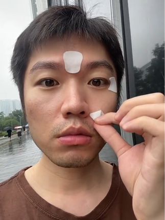 #法令纹贴 #法令纹 #鱼尾纹 #川字纹 #抬头纹