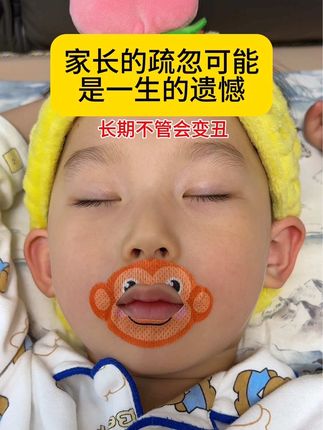 养娃不易,孩子长期开口睡觉,家长要重视#张嘴呼吸会变丑 有了这个闭口贴,再也不用担心了#儿童闭口贴#母婴好物