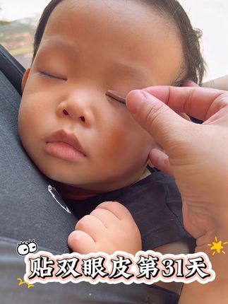 贴双眼皮第31天,一定要看到最后!嘿嘿,我们快成功了#人类幼崽 #贴双眼皮贴 #萌娃 #日常vlog