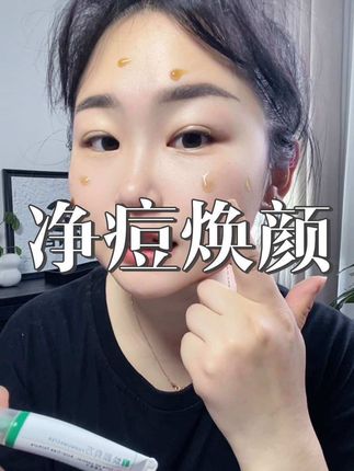 爆痘姐妹必冲!梁云生都听过吧,草本植物提取,特别温和#焕颜有方 #祛痘凝胶 #护肤好物