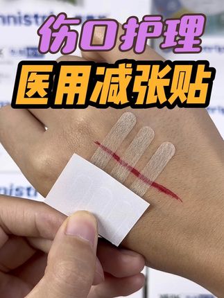 黑怕疤痕变大变丑的朋友,你就选这款奥嘉莱减张贴,真的有效果#医用减张贴