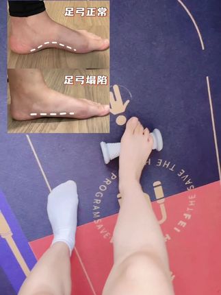 直腿的根基在足弓,按摩脚底筋膜,每天必做#直腿训练#足底按摩 #纠正腿型 #筋膜滚轮