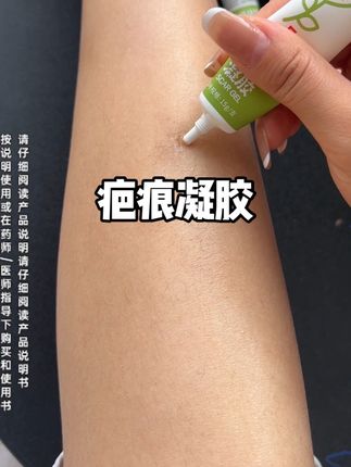 #疤痕凝胶 真的没有必要买贵的,认准医用硅酮是关键,咱国货老牌子就很给力#医用硅酮 #自用好物推荐