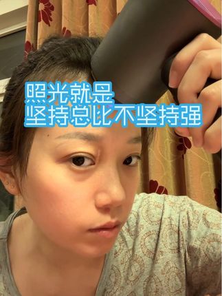 依旧是照光日记,慢慢恢复中,眼角比较明显#每天进步一点 #白癜风 #白癜风光疗 #白癜风复色 #白癜风科普