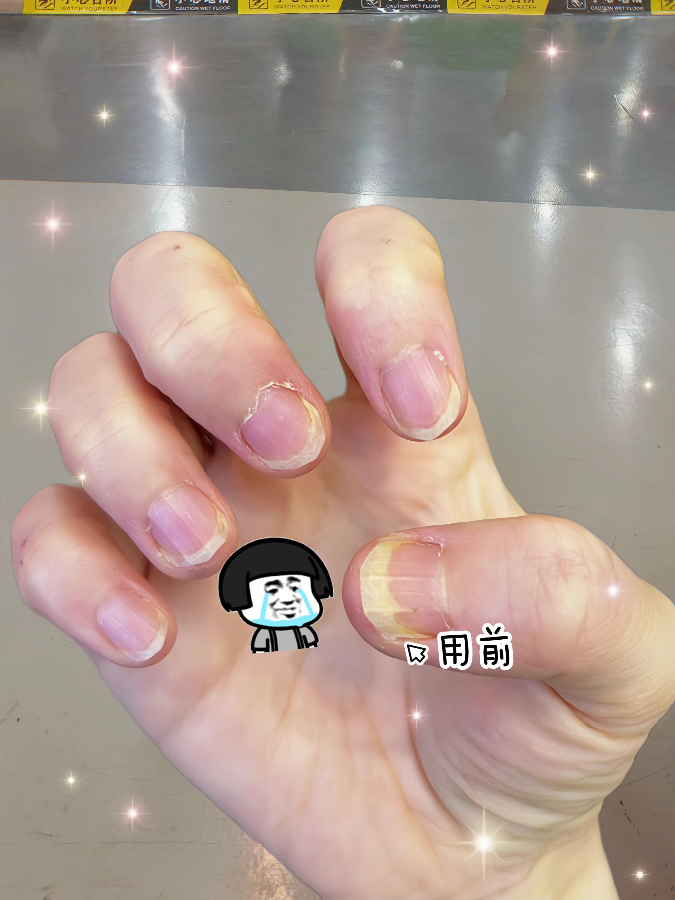 #强烈推荐 #看过来 #灰指甲 #每日分享#上岸上岸上岸 #每日分享