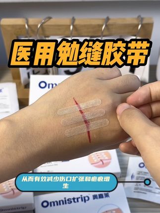 黑怕疤痕变大变丑的朋友,你就选这款奥嘉莱减张贴,真的有效果#医用勉缝胶带#医用减张贴