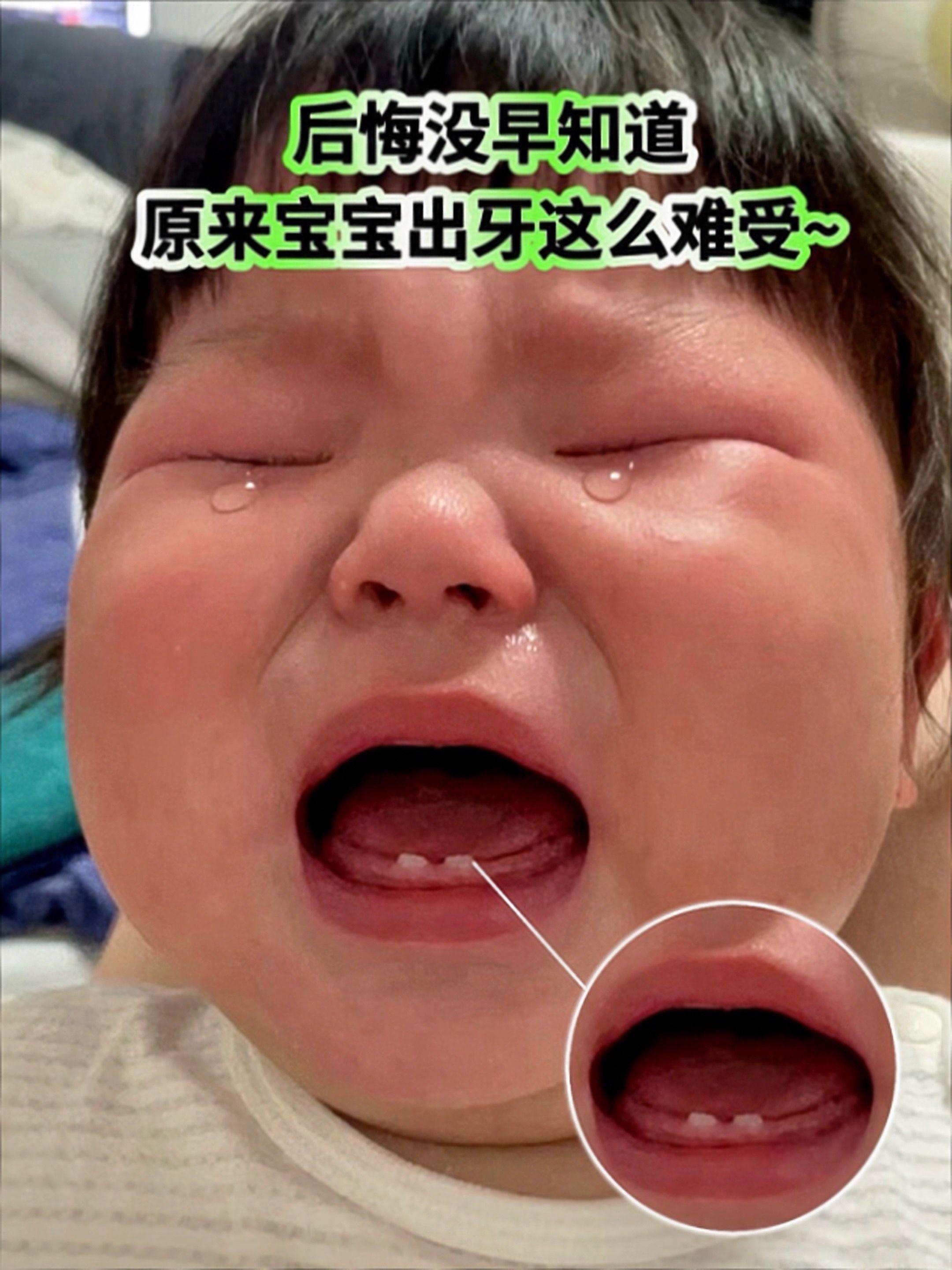 出牙期宝宝哭闹怎么办?这个时候你就需要给它安排一根磨牙棒了,但是一定要选这种婴标的,安全又放心。英氏家的磨牙棒我家宝宝很喜欢,波浪形的设计更容易抓握,还自带一个硅胶手绳,绑在手腕上不容易掉。#英氏防掉磨牙棒