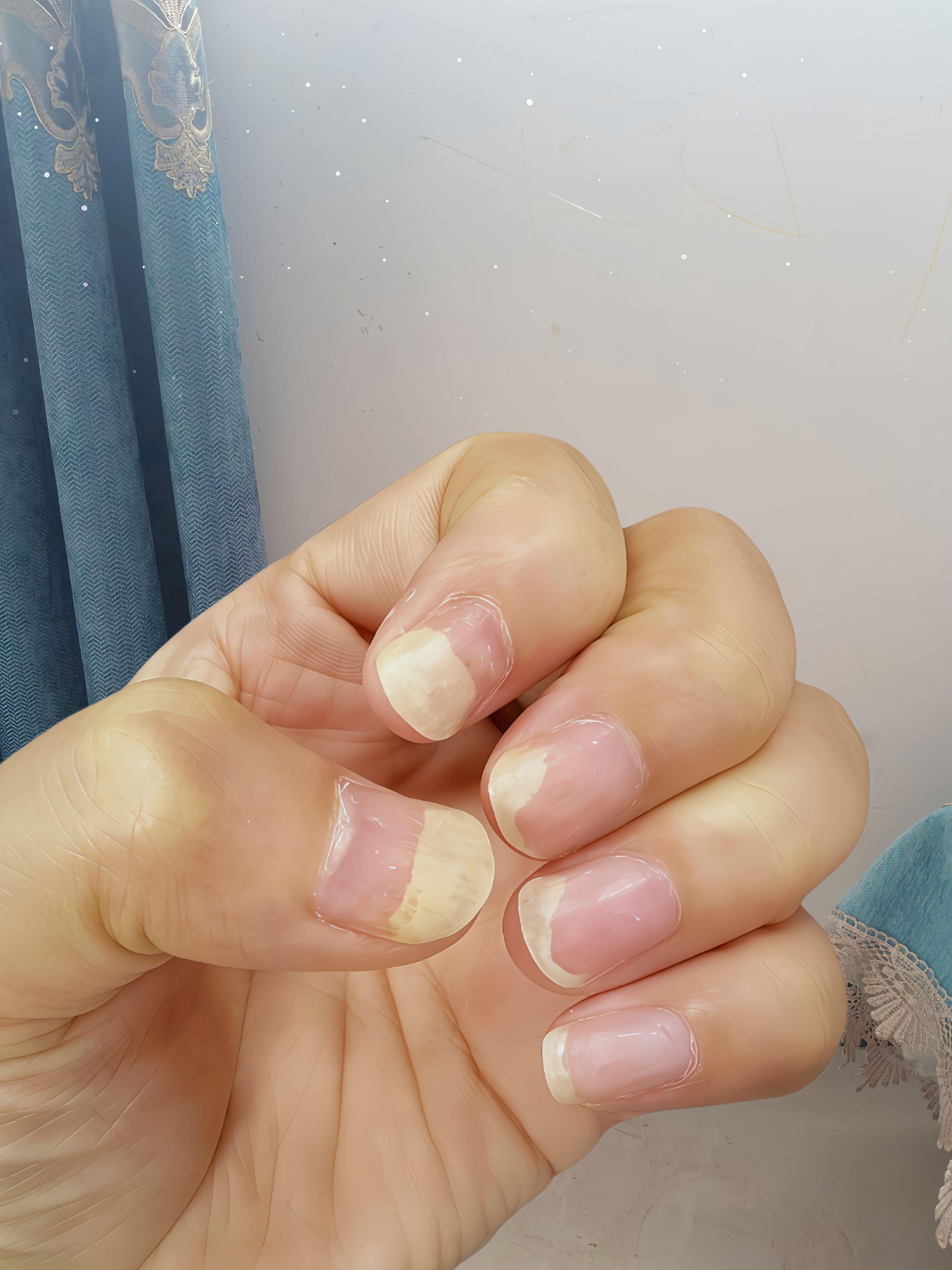 #强烈推荐 #看过来 #日常分享 #脚丫子 #可爱的小脚丫