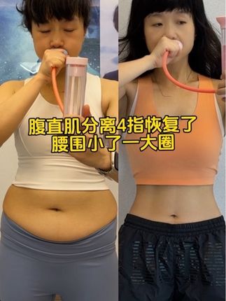 生完二胎#肚子大 #腹直肌分离,要做腹式呼吸又不知道怎么练,你就试试这个呼吸哑铃,双向可调节负重帮助我们更快的找到腹部发力感。每天200个,坚持一段时间打造沙漏腰#宝妈 #产后恢复 #瘦肚子
