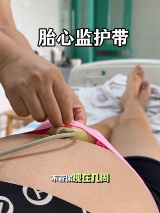 #怀孕 的姐妹们不管几周提前安排#胎心监护带 公用的很不卫生很容易交叉,自带的卫生,进产房生孩子也要用#待产包#孕期好物#胎心监护
