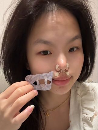 我的天,本来只是想试试,没想到这么好用…#口呼吸贴 #矫正贴 #种草 #好物分享