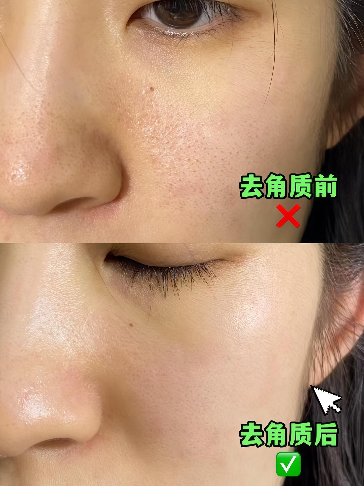 毛戈平去角质霜真的有点东西,深层清洁毛孔,天一热,脏东西容易堆积,做好清洁很重要#去角质#毛戈平去角质霜 #温和清洁 #美妆 #好皮肤养出来