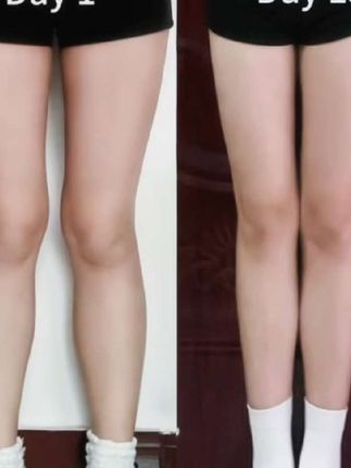 拉筋板斜踏瘦腿拉伸神器男女儿童家用脚型矫正器脚踏健身运动器材#踏板拉伸训练器#健身拉筋板#男女儿童通用健身拉筋板#改善腿型拥有长直腿 #放松肌肉健身运动器