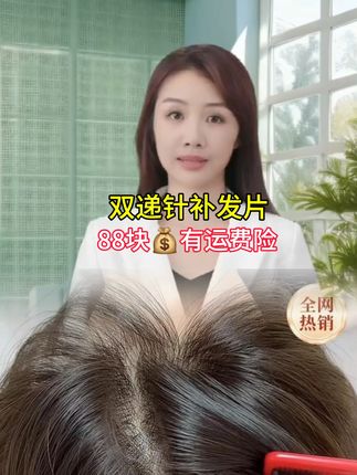 #双递针头顶补发片升级款#夏季薄款一年四季可以佩戴