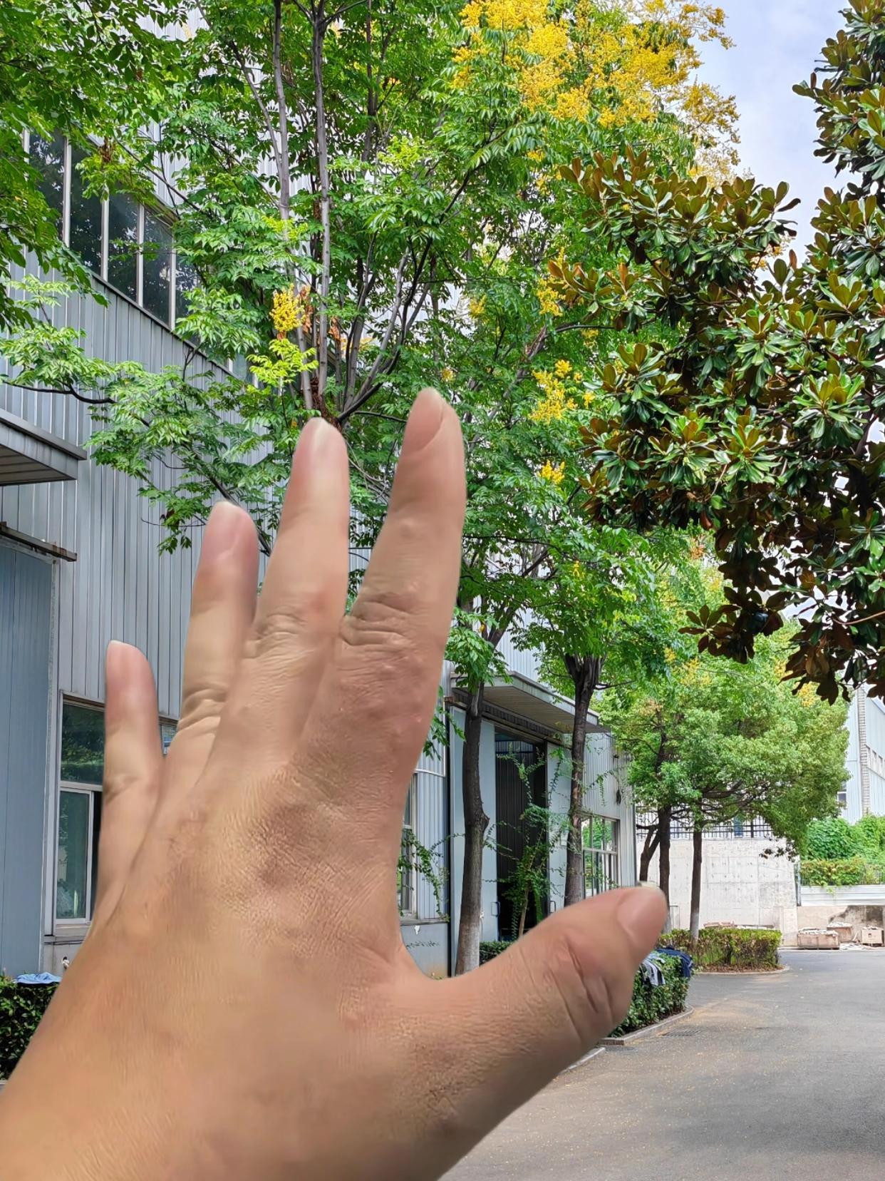 #汗疱疹 #湿疹 #湿疹反复 #记录日常生活 #手上有水泡