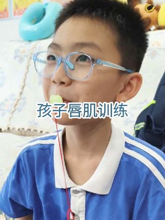 #创作灵感 孩子👶🏻习惯性口呼吸,上嘴唇闭合力差,嘴唇变翘的,一定要给孩子进行唇肌训练,真的很好用,别让不好的习惯影响了长大后的样子了!#张嘴呼吸会变丑#张嘴睡觉 #腺样体面容