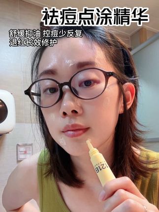 青春期的孩子或者是咱们大人脸上总是油腻、长痘的,真的可以试试#一页 #1218祛痘 #点涂精华 它是控油祛痘修护三合一#青春期护肤