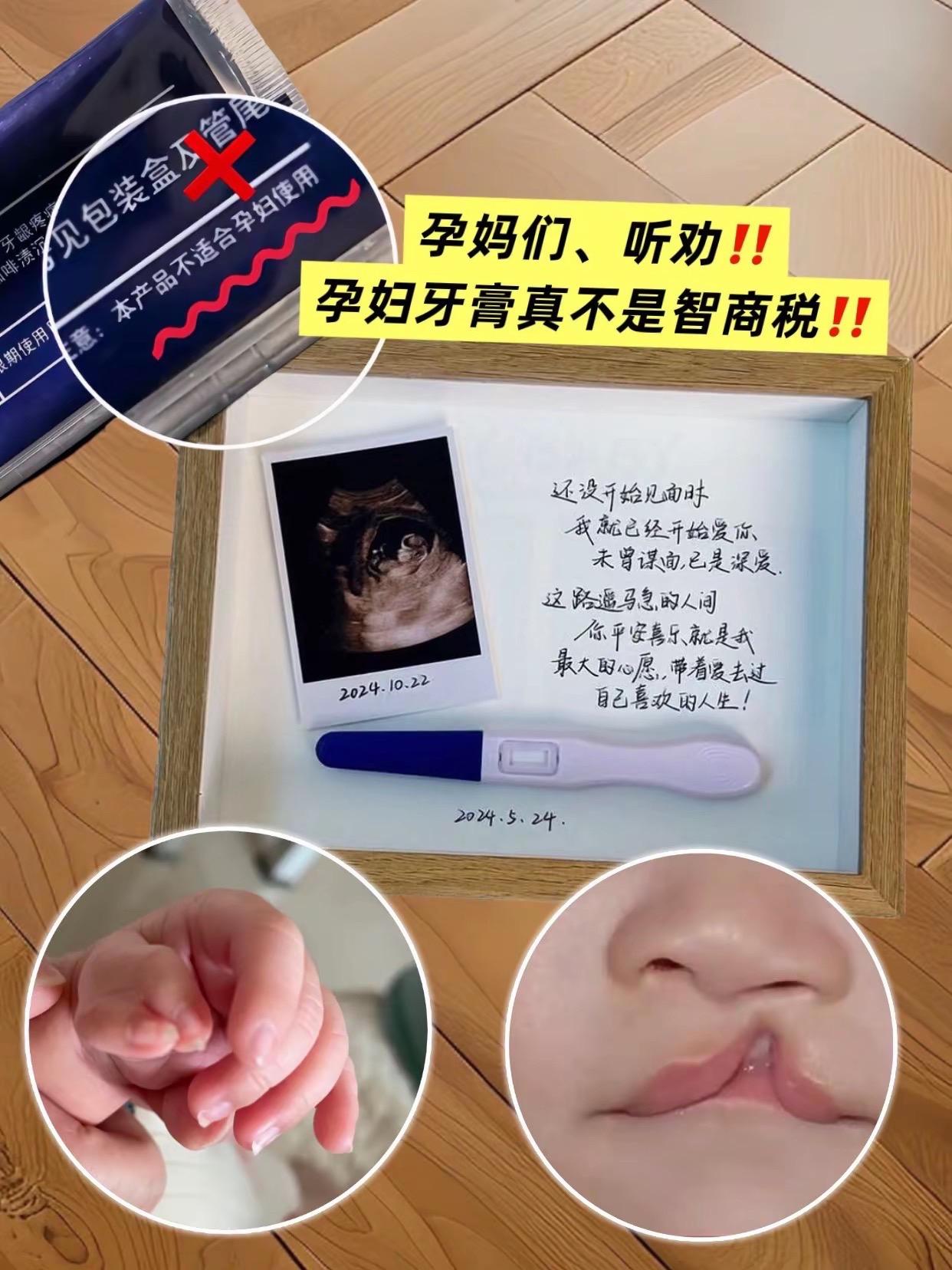 孕🤰妈妈们,怀孕了家里的普通牙膏就不要再用了,要换一个孕妇专用的!这款澳兰黛孕妇专用牙膏很不错 哦!无氟配方,成分很安全,有橙子和蓝莓两种口 味,可以清新口气,用了刷牙不再恶心,可以放心使 用也不贵,还没准备的姐妹赶紧入#孕期口腔护理#孕期囤货 #孕妇牙膏