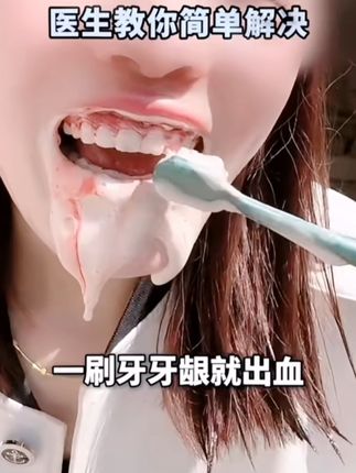 牙齿敏感、牙周炎?这款口腔护理产品给你治好!#好物推荐🔥 #牙齿 #牙周炎 #医用 #口腔健康