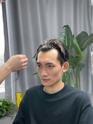 告别尴尬秃顶,隐形鬓角贴拯救你的自信瞬间! 头发稀疏、秃顶烦恼多?这款假发片帮你解决!#假发#假发补发#发型#增加发量#变美课代表给秋天划重点了