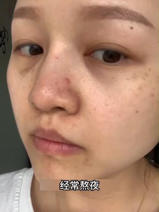 玫瑰纯露湿敷水好大一瓶,便宜又好用,湿敷一点不心疼 #人工采摘 #女生必备 #湿敷水 #去黄提亮 #补水保湿