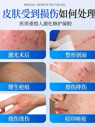 皮肤有划痕、磕碰留下的印子?试试这款产品!#好物推荐🔥 #胶原蛋白敷料 #三型胶原蛋白 #疤痕增生