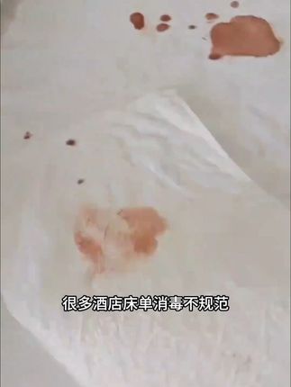 权威报告检测!HPV16病毒灭活率>99.99%!随身携带消毒喷雾,出行更安心!#预防hpv #hpv预防 #消毒杀菌喷雾 #出行好物推荐
