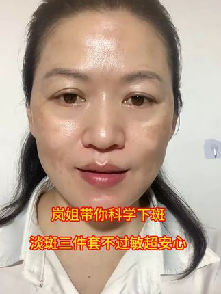 淡斑总过敏的看过来,岚姐专属淡斑三件套超安心 #初秋必学的琥珀妆 #祛斑攻略#美白淡斑
