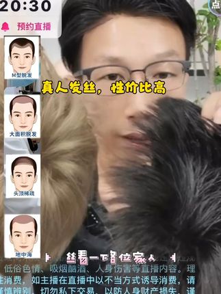 告别脱发烦恼,真人发丝隐形假发太神奇了! 头发少、秃头烦恼多?这款假发帮你解决!#假发 #光头 #秃头 #男的假发 #男人 #男士发型