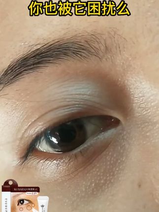 还在花大价钱去美容院处理脂肪粒? 这款神器直接省大钱!22 种和汉草精华 + 微量水杨酸,温和渗透,脂肪粒自己掉光光,效果堪比专业护理#脂肪粒去除小妙招 #脂肪粒去除神器 #脂肪粒怎么去除 #眼部精华