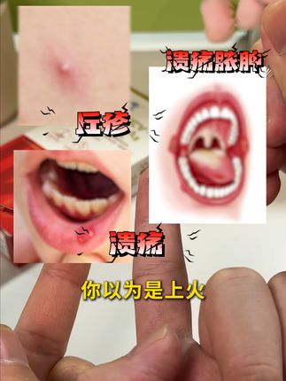 恋爱前必做!快速检测安心相伴 担心自己有性病?这款试剂盒在家就能测!#梅毒科普 #异地恋 #大学生 #奔现 #万孚试纸四合一
