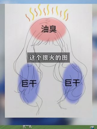 青少年和成人都可以使用的二氧化硒洗发水,每天大油头,如果你也是早上洗完下午油,轻轻一浇雪花飘的,那就去试试这款二硫化硒洗发水#洗发水 #二氧化硒 #脂溢性皮炎 #去屑止痒 #青少年