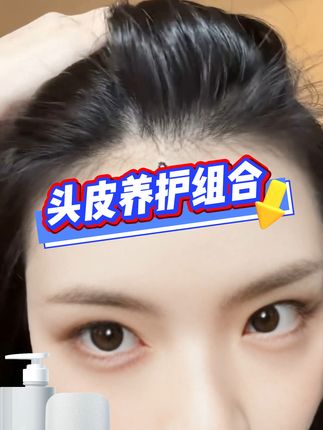 头皮抗老要趁早 头皮越用越年轻,秃头姐妹速冲! 神仙水同款二裂酵母! 百元不到给头皮灌黄金 头皮油腻绝缘3天!#采乐二裂酵母头皮清洁梳 #二裂酵母 #头皮护理 #毛囊清洁 #头皮抗衰 
