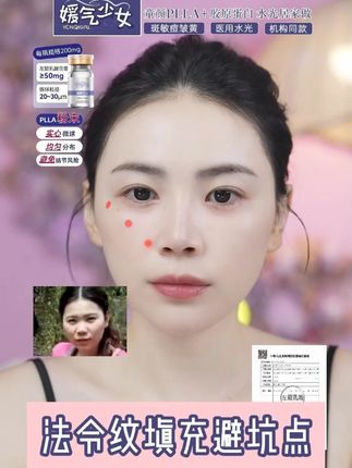 法令纹填充一定要注意 #媛气少女YONQIGIRL #媛气少女童颜PLLA #媛气少女胶原蛋白 #媛气少女居家水光 #三型胶原蛋白