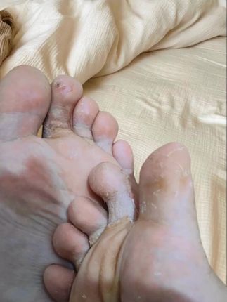 #足部护理 #可爱的小脚丫 #记录真实生活 #日常分享