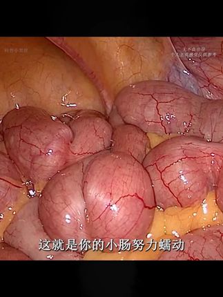 兄弟姐妹们,改变就趁现在,赶紧行动起来吧#强烈推荐 #涨知识 #科普一下 #胖子都是潜力股 #啤酒肚