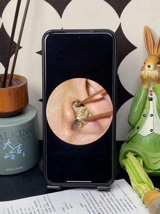 如果掏耳朵有段位的话,我肯定是高分段位,无敌是很寂寞的,谁来挑战#可视掏耳勺#掏耳朵#掏耳朵好舒服#掏耳神器