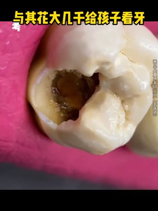 孩子牙齿发出的信号一定不能忽视#禾贝儿童牙膏