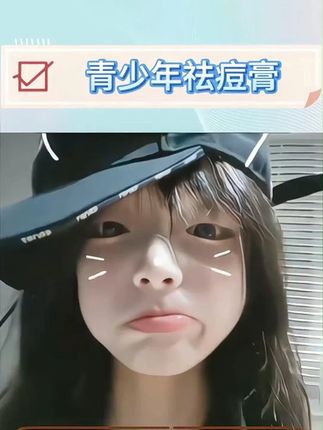 真的好好用!这可是青少年专研 痘痘肌有福了 温和不刺激 建议姐妹们人手必备#青少年 #祛痘膏 #青春期 #痘痘黑头粉刺拜拜 #小孩姐