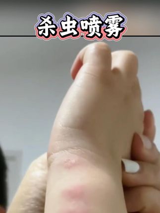#黄子韬 #杀虫喷雾 #杀虫喷雾剂 #黄子韬推荐 #黄子韬直播