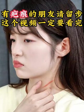 有疤痕的朋友请留步!看完这个视频您一定会回来感谢我的! #肝素钠尿囊素凝胶 #好物推荐 #种草 #淡疤痕