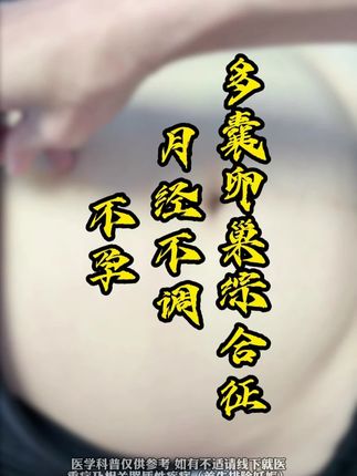 #多囊卵巢综合征 #月经不调 #不孕 #针灸调理 #中医蔡主任