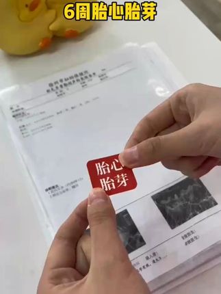 #家居好物分享 今天去做检查这个东西可以帮了大忙,前面可以放各种卡片,做好检查的报告单都装进去收纳,拉上拉链也不会掉落#孕期 #产检
