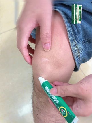 #膝盖不适 #膝盖关节 都适用