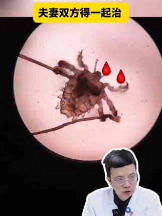 破壁机性价比战神 #硫磺软膏   #硫磺软膏的功效和作用   #疥虫的症状   #螨虫的危害   #无限回购的宝藏单品