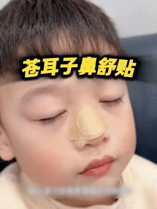 #苍耳子 终于升级成鼻贴了!一撕一贴方便又卫生!全家都可以用#宝宝护理 #换季必备 #母婴好物 #宝妈分享
