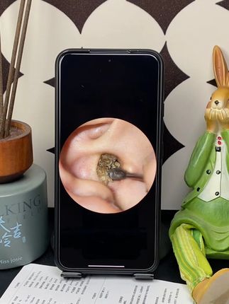 十八年没有掏过的耳朵你们知道长什么样吗?今天就让你们开开眼,这要是掏不出来,就彻底完犊子了#可视掏耳勺#掏耳神器#掏耳朵#掏耳朵好舒服