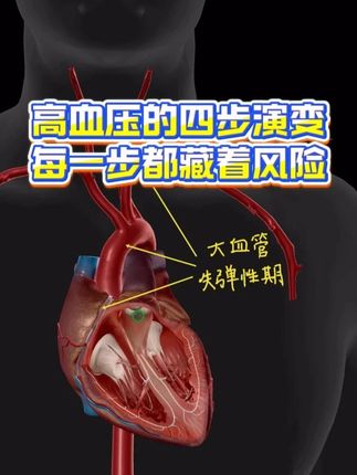 血压不是一天就飙高的,你的血管其实早就有了变化。 #抖出健康知识宝藏#健康科普不基础#高血压#降压药#夜间高血压