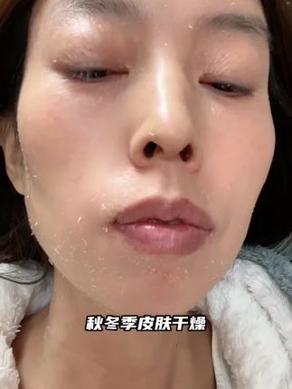 懒人以油养肤新选择!伊贝诗 91 悬油水,小分子水油好吸收,喷头一喷超方便,皮肤嫩得像喝饱精华~#伊贝诗 #妆前神器 #伊贝诗91悬油水 #以油养肤 #干皮救星